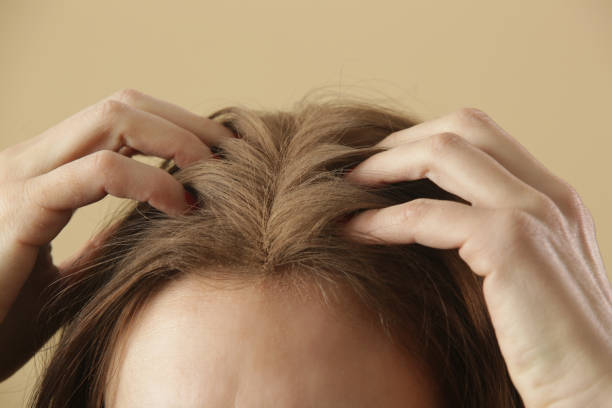 Dry Shampoo
