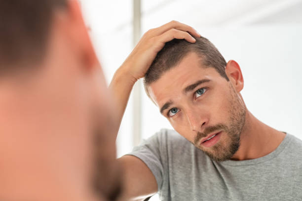 Scalp Concerns